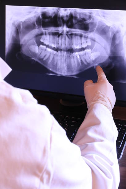 Best Broken or Chipped Tooth Repair in Leonia, NJ
